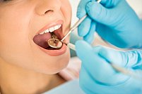 3 boli orale care pot duce la pierderea dinților